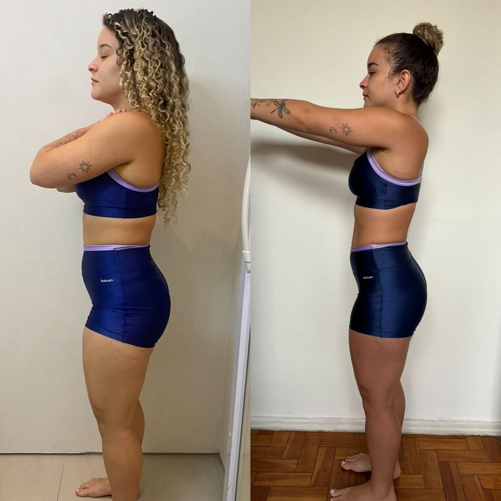 Resultado de acompanhamento — antes e depois