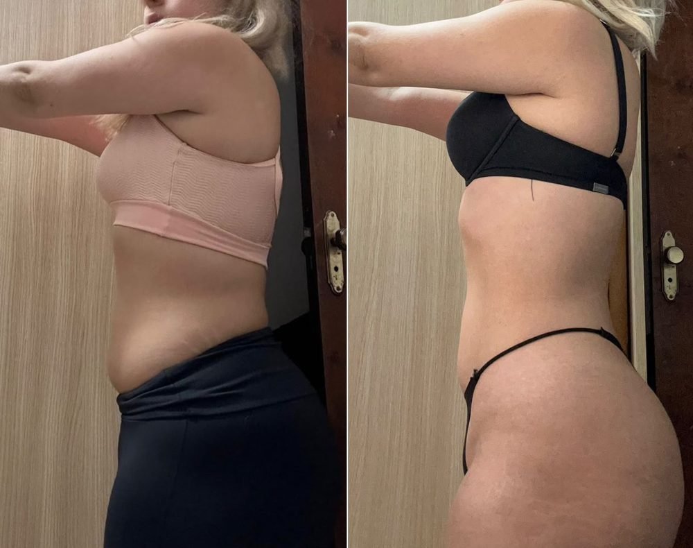 Resultado de acompanhamento — antes e depois