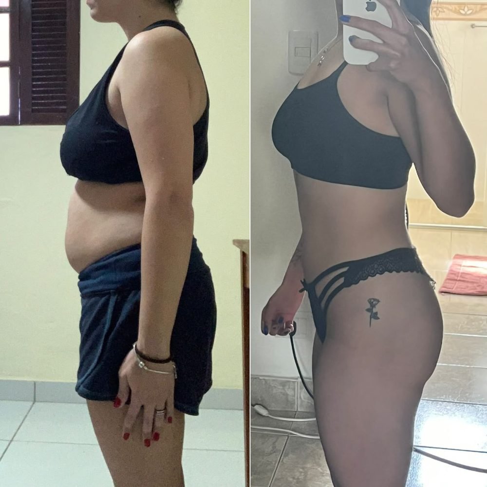 Resultado de acompanhamento — antes e depois
